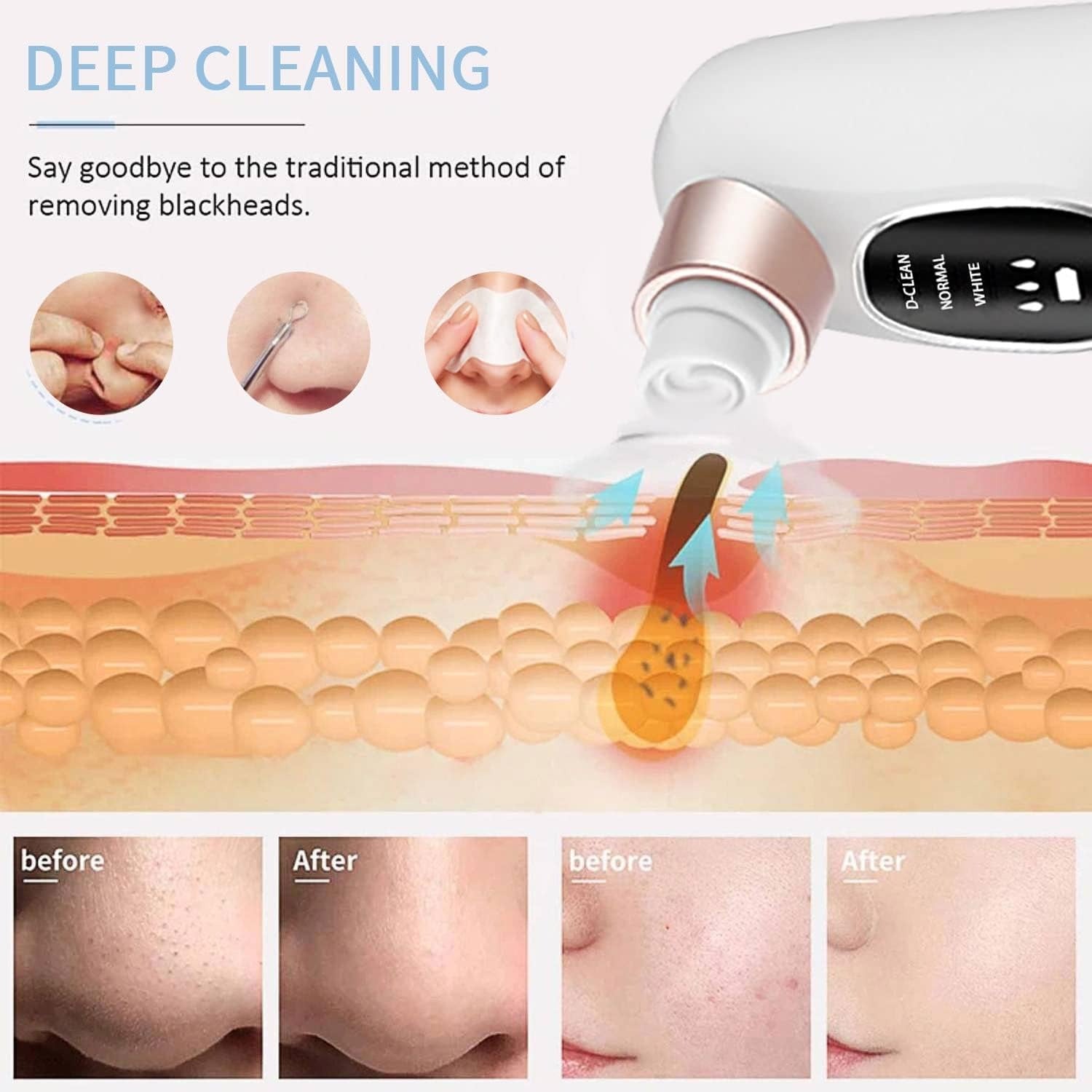 Electric Deep Cleansing Machine – Blackhead Remover with Vacuum Suction & Hydro Facial Cleaning